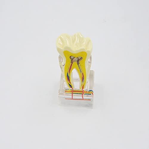 UCCE 6X דגם אנטומיה מודל פתולוגיה מודל עצב שיניים הוראה אנטומיה מודל שיניים הדגמה רפואית