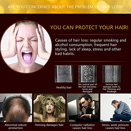 אנדריאה צמיחת שיער מהות שיער אובדן קרקפת טיפולים ג ' ינג ' ר גנסנג להעלות צפוף שיער להפסיק שיער אובדן נוזל עבור