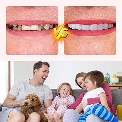 שיניים מזויפות, 4 יח 'שיניים שיניים לנשים וגברים, פורניר שיניים לשיקום שיניים זמני, טבע ונוח להגן על השיניים
