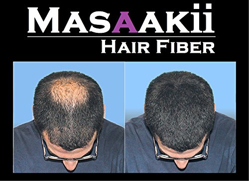 מסאקי שיער סיבי 0.87 עוז / 25 גרם - מהיר שיער אובדן טיפול קנדה