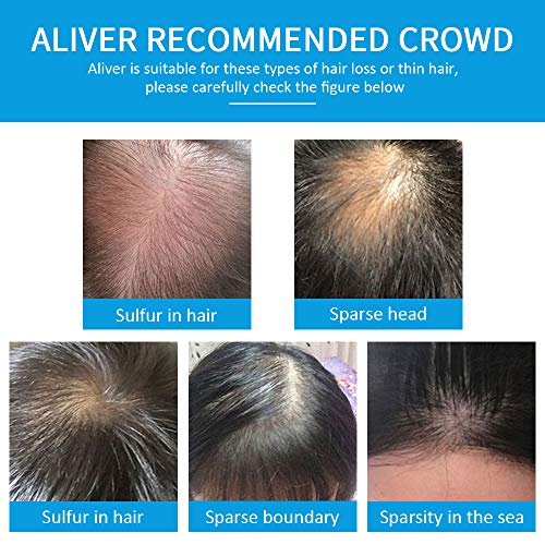 סיבי שיער אליבר לשיער דליל חום כהה-נוסחה טבעית בלתי ניתנת לגילוי - שיער מלא יותר עבה תוך 15 שניות-מסתיר