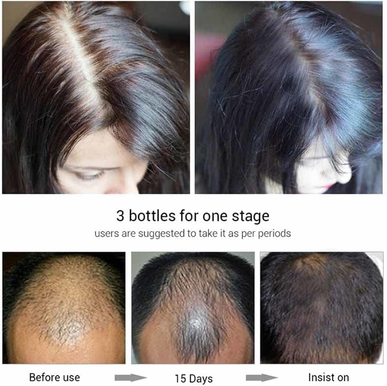 ג ' ינג ' ר שיער צמיחת חיוני שמן סרום אנטי שיער אובדן מוצרים מהיר לגדול שיער טיפול תיקון קרקפת מקורזל