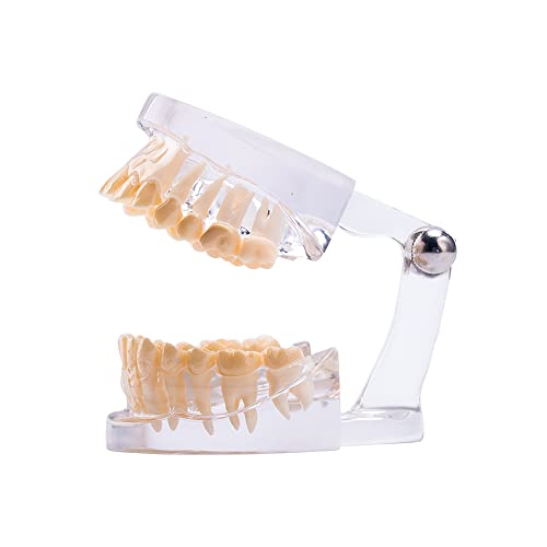 סנאופ שיניים סטנדרטי שיניים דגם צלול שן שנן דגם עבור אוראלי שיניים מחקר הוראה וחינוך